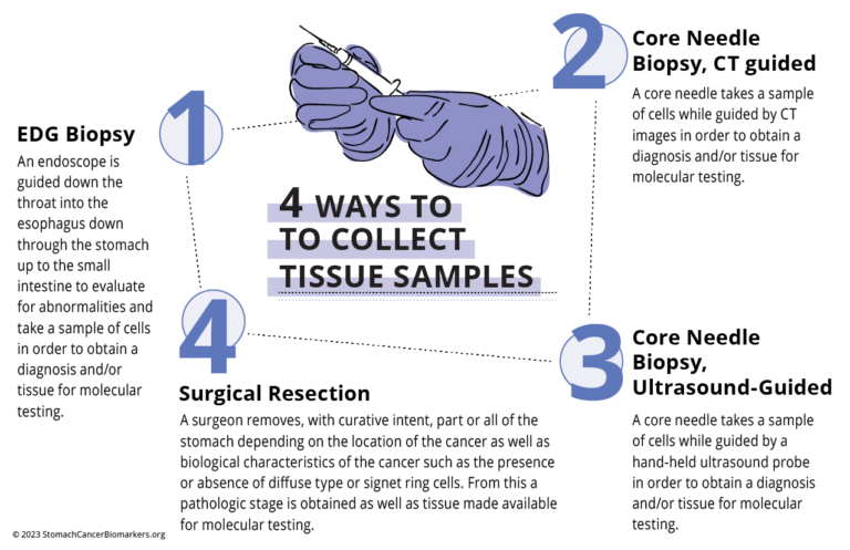 Biomarker Chart - 4 Ways To Collect Tissue Sample